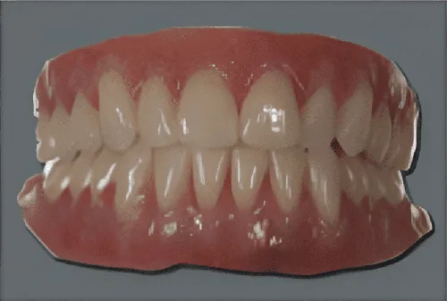 Full and Partial Dentures