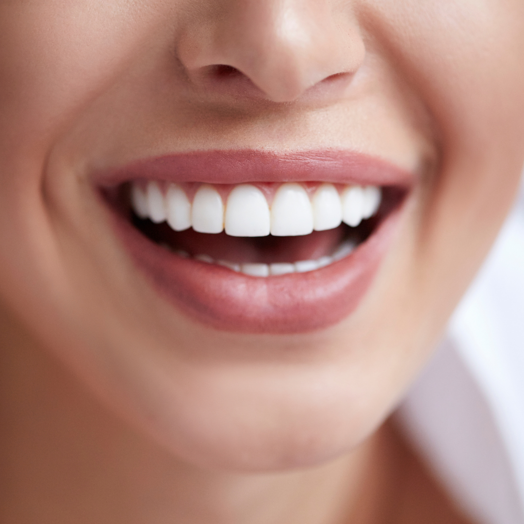 Clear Smiles Braces Orlando Orthodontist Florida Clear Smiles