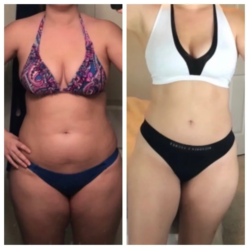 Medical Weight Loss Semaglutide and Tirzepatide Shea Aesthetic Clinic