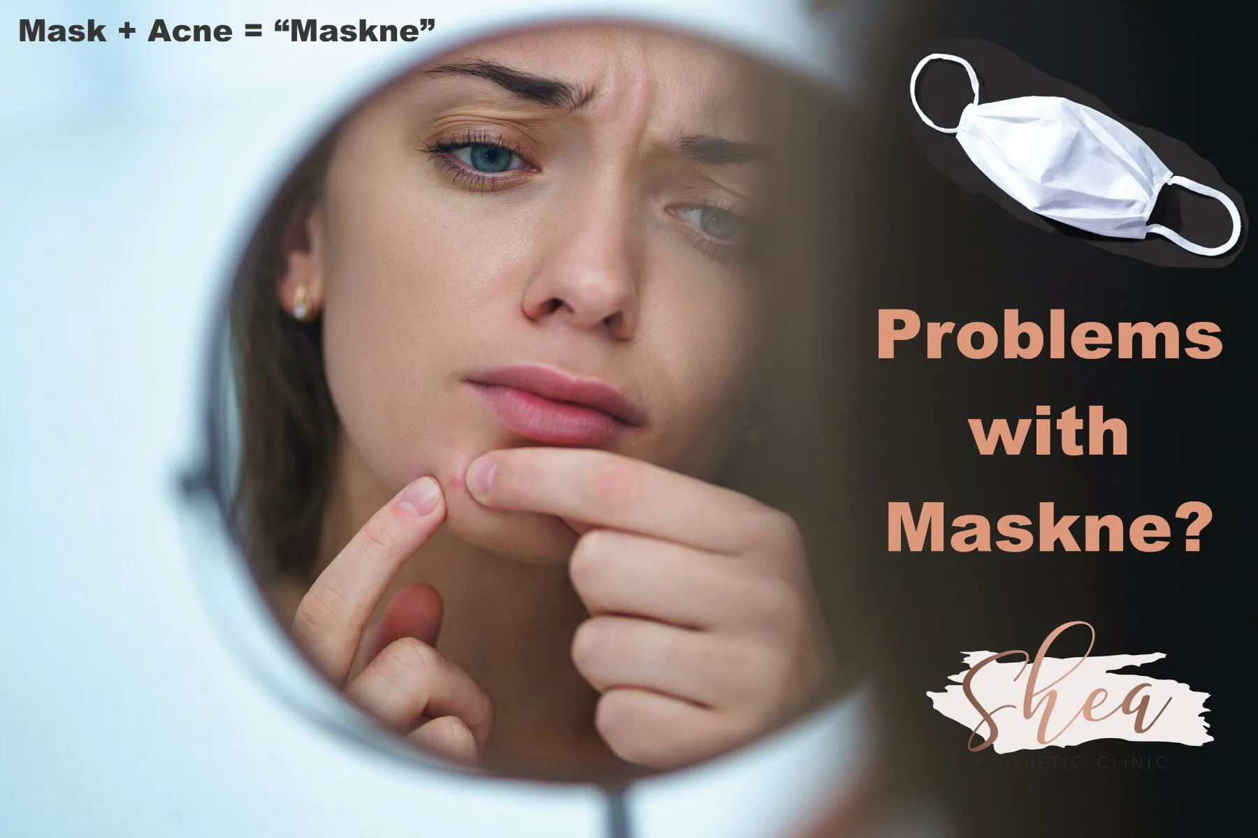 How to Treat Maskne (Mask Acne)