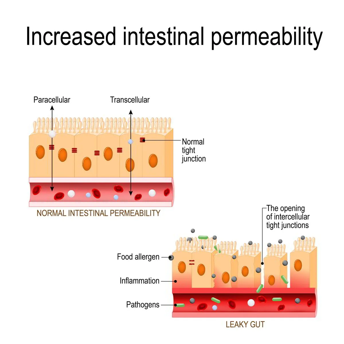 bpc-157 tight junction intestinal permeability study Breaking the Barrier: The Role of Gut Epithelial in the Pathogenesis of Hypertension | Current Hypertension Reports Frontiers | Stable Gastric Pentadecapeptide
