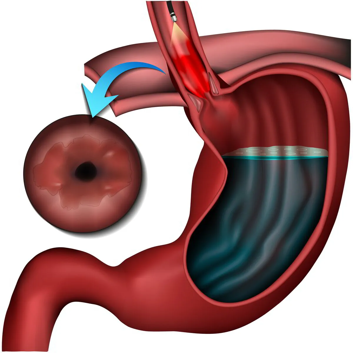 what are signs of mouth cancer from chewing tobacco Oral Changes Associated with Tobacco Use