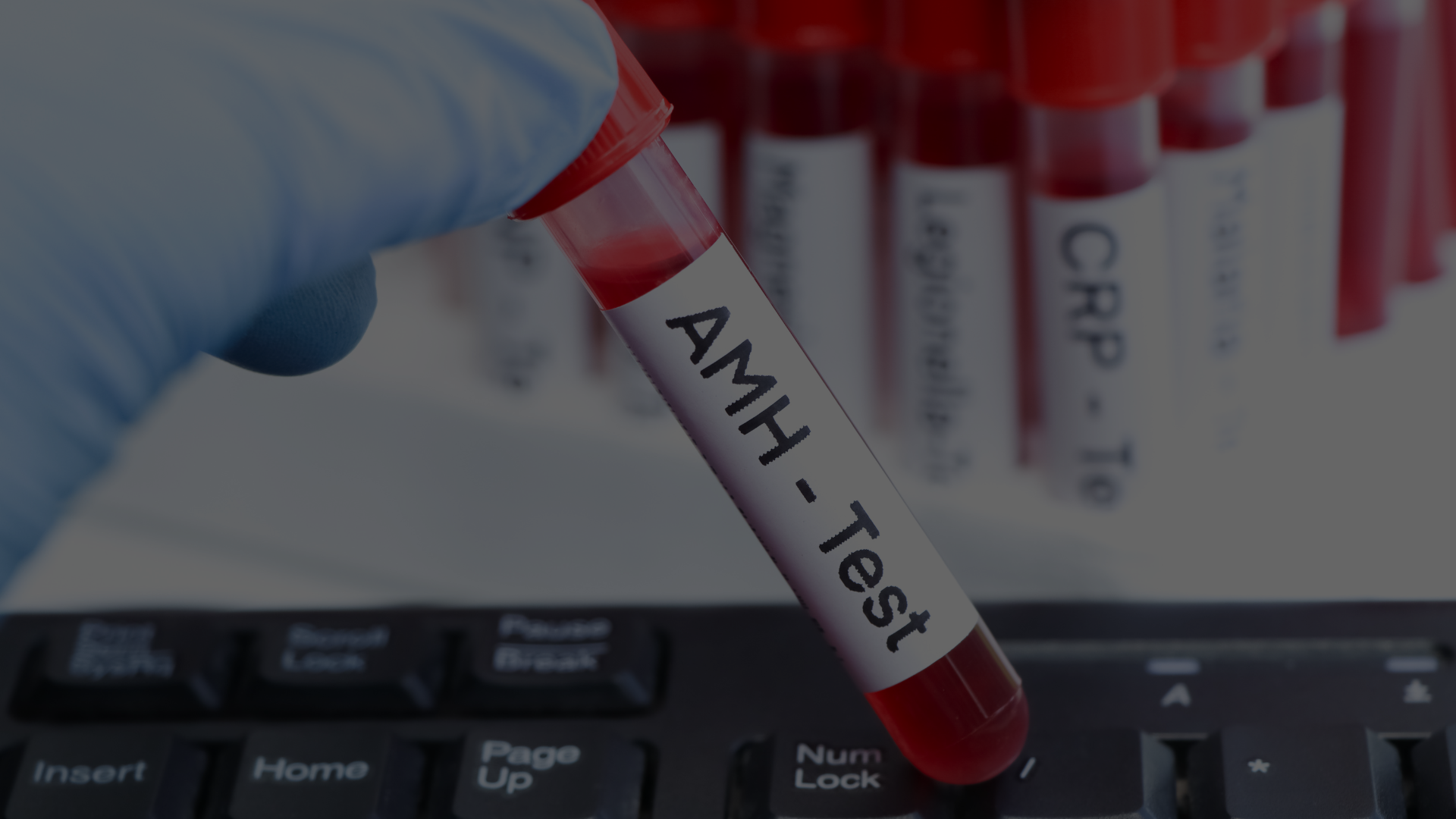 Understanding AMH: Low, Normal, and What It Really Means for Pregnancy