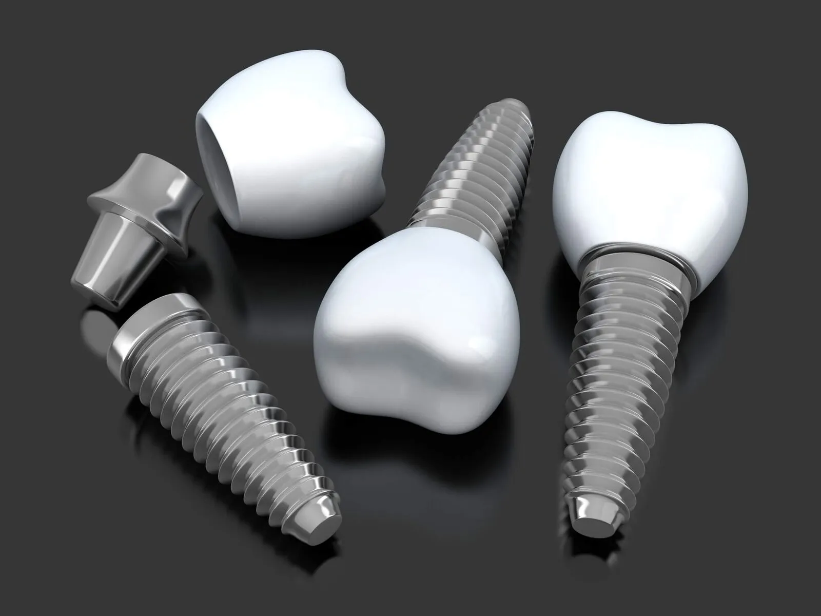 Common Questions People Ask About Dental Implants 