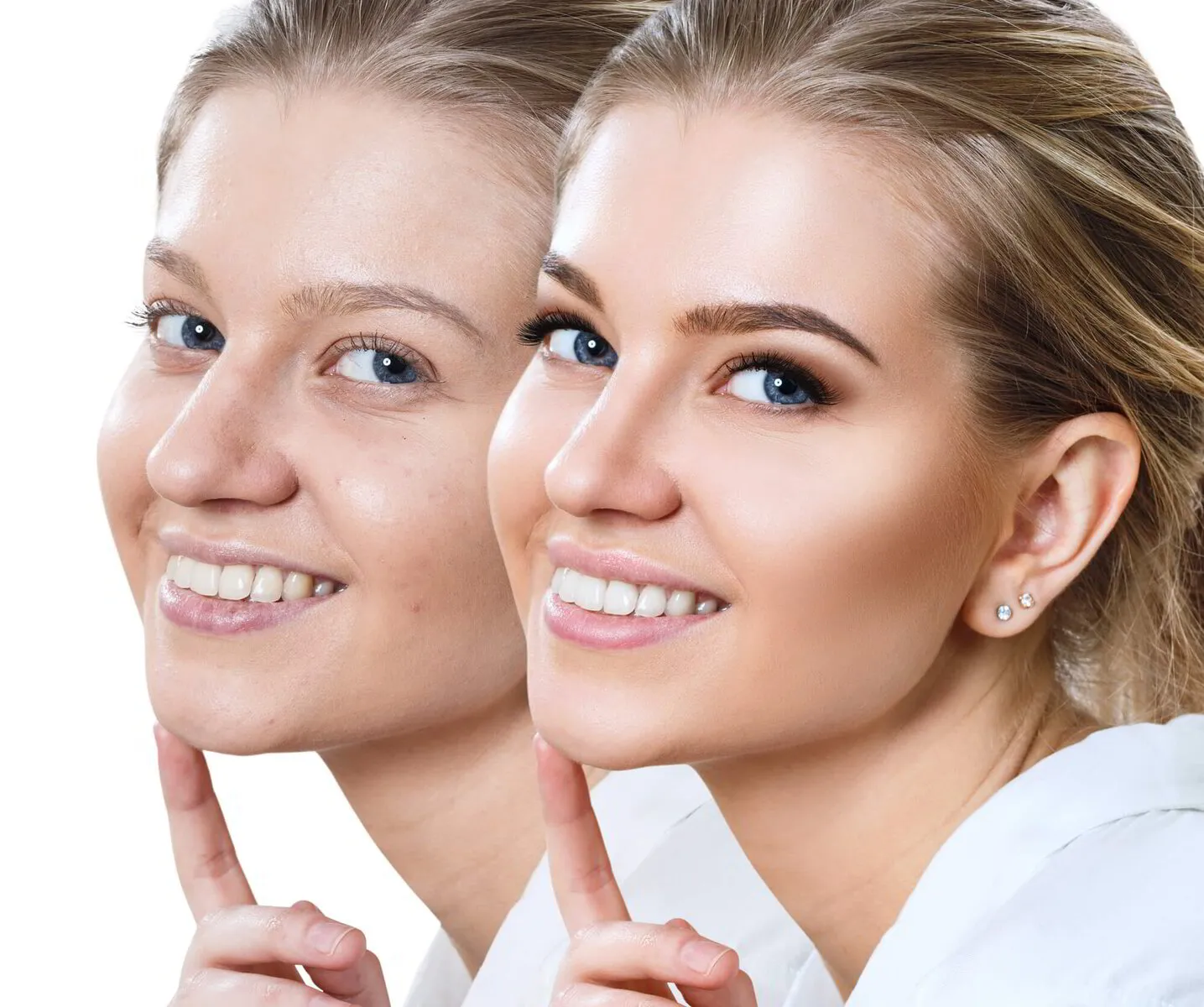 Smile Makeovers and Aging: 5 Strategies for a Youthful Appearance