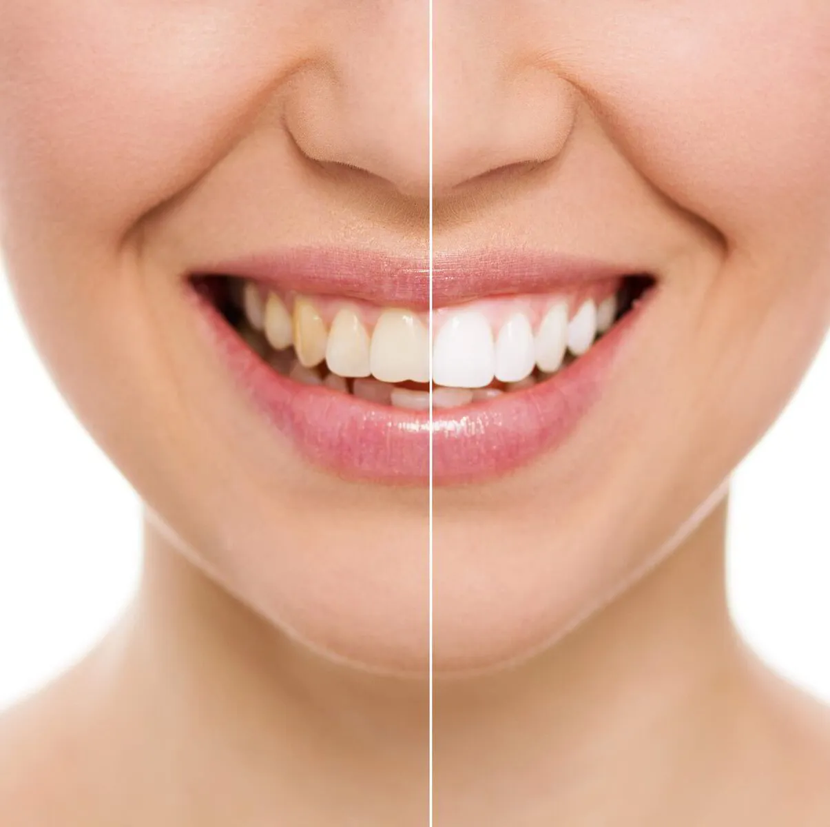 How to Choose the Right Cosmetic Dentist for You