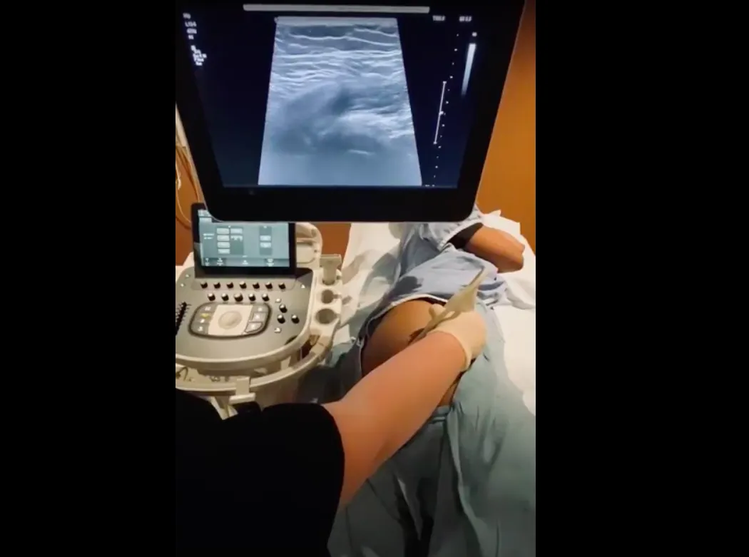 Lateral Scan Lateral Hip Scanning Tips