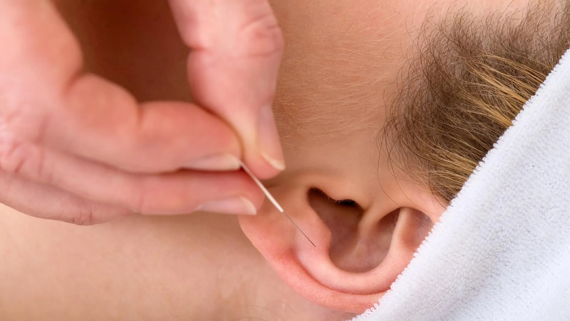 Ear Acupuncture: The Healing Potential Of Auricular Therapy