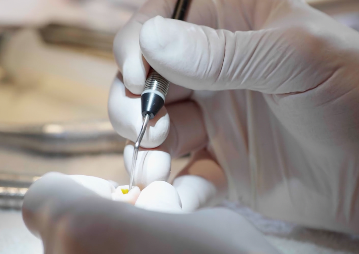 The Art of Minimally Invasive Endodontics Course