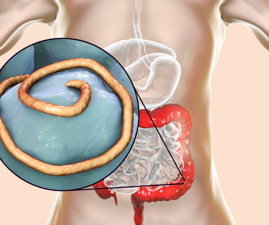 Parasites: A Naturopath’s Guide to Gut Health, Symptoms, and Natural ...