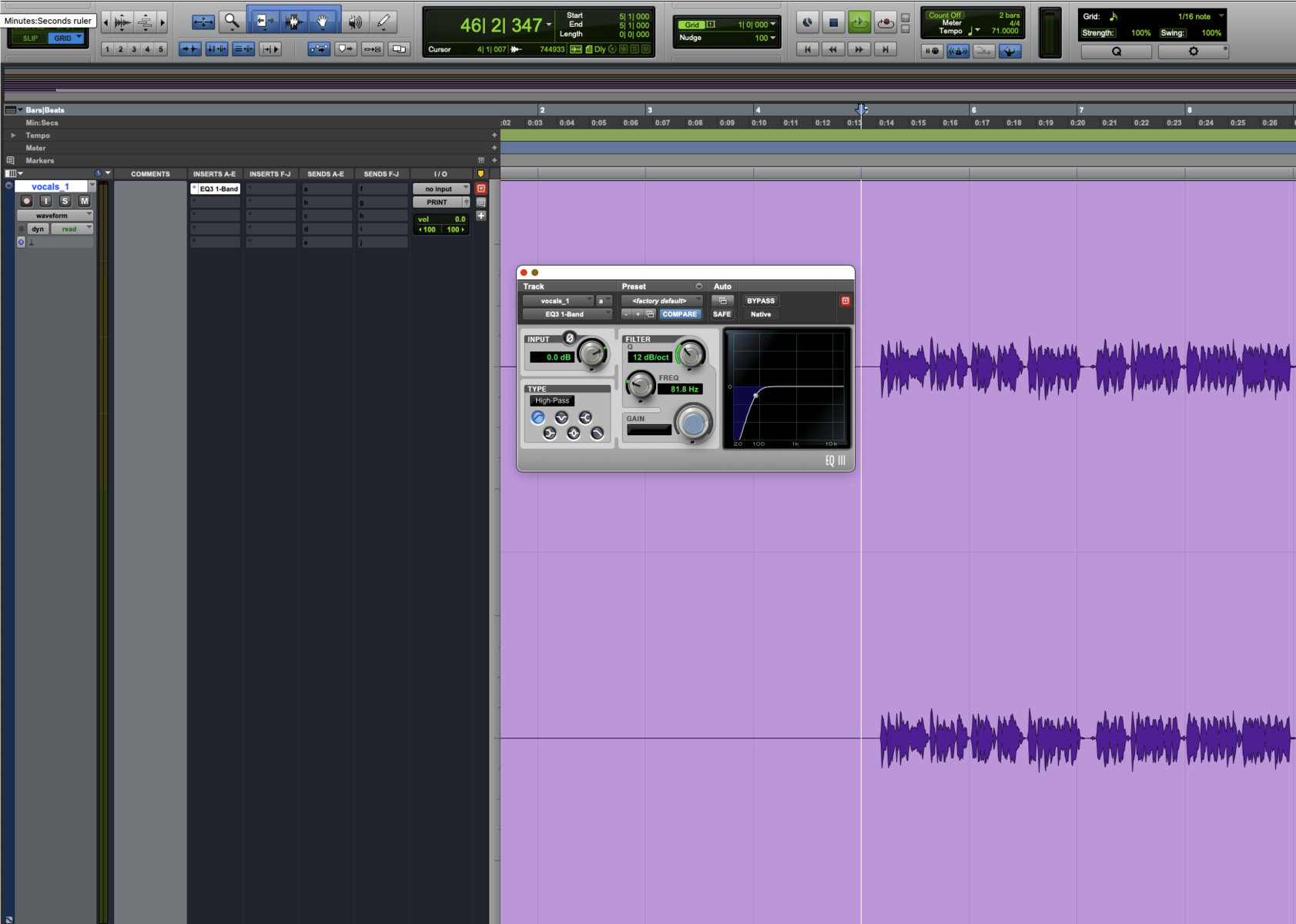 The Vocal Processing Chain: Complete Order and Settings Guide (Step-by ...