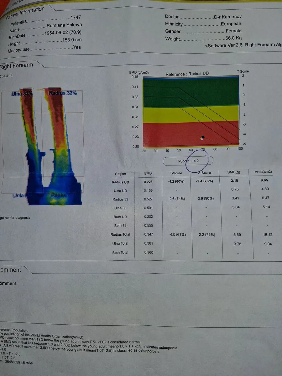 Начално DEXA измерване на Румяна