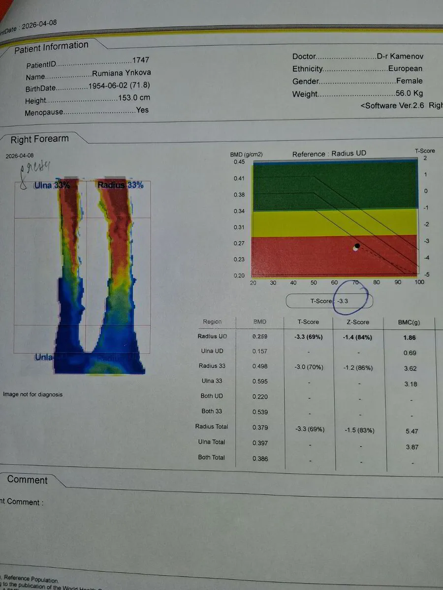 Контролно DEXA измерване на Румяна