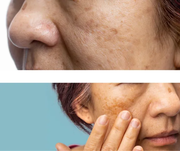 雪美人スキンコンディショナー