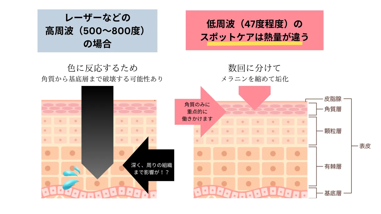 低周波のシミケアを受ける前にご確認頂きたいことがあります