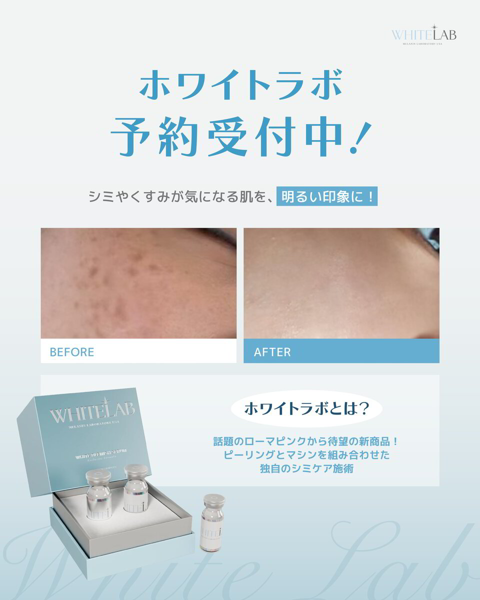ホワイトラボ施術の注意事項まとめ｜初めての方必見！安心して受けるために