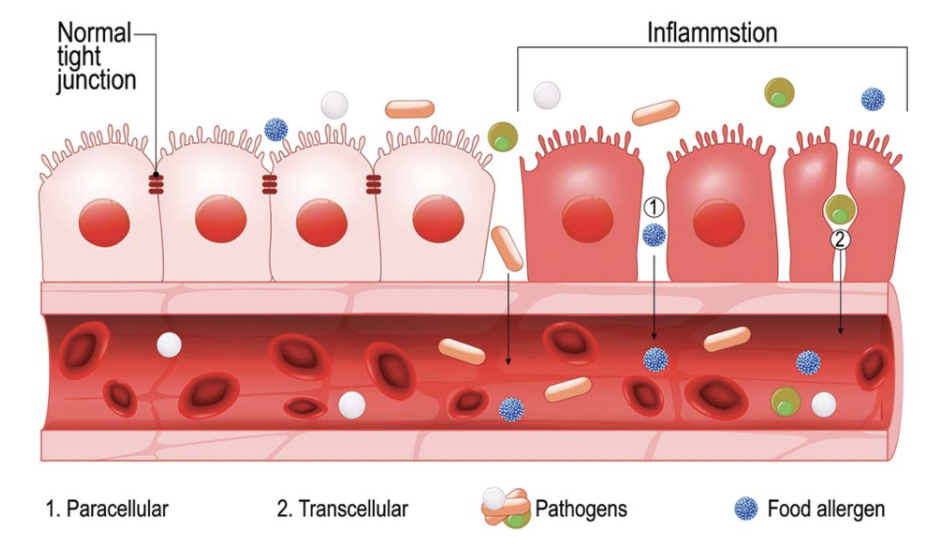 intestinal-permeability-this-might-be-the-root-cause-of-your-digestive