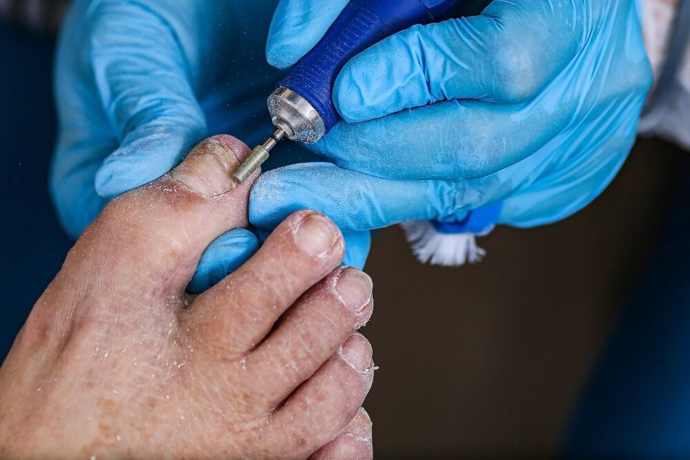 Ce este podologia? Din punctul de vedere al unui podolog din Germania