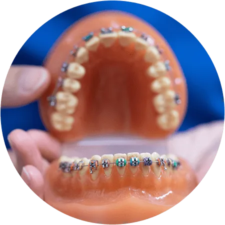 Graceville Dental Practice can help you with orthodontics