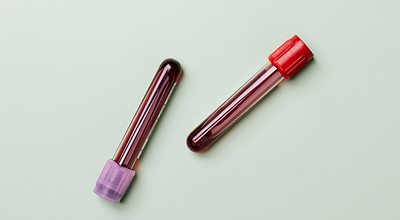 Lab Testing