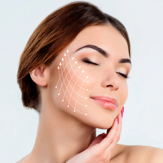 Redensificación Ultracol