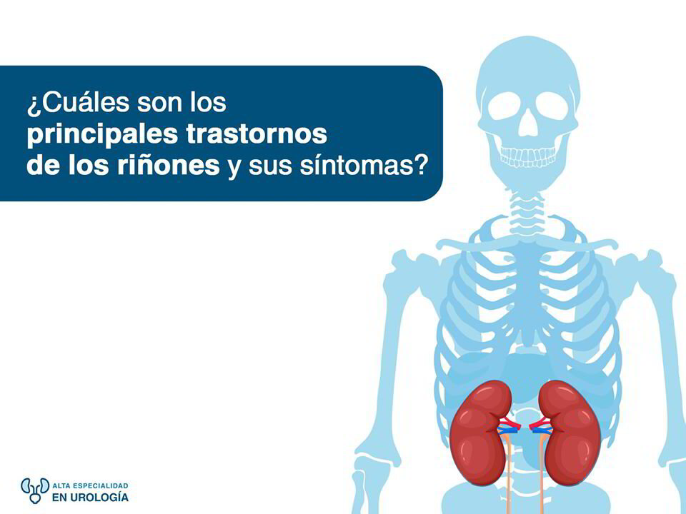 ¿Cuáles son los principales trastornos de los riñones y cuáles son sus ...