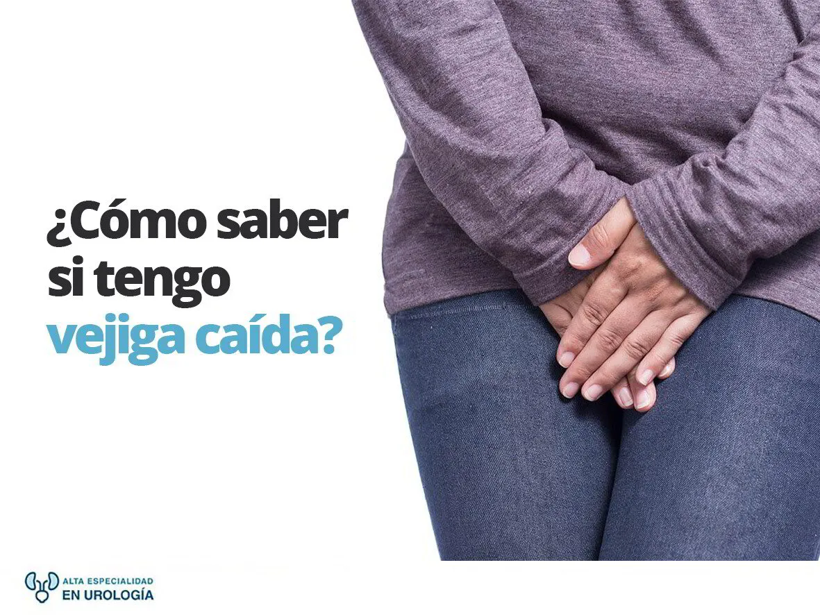 ¿Cómo saber si tengo vejiga caída?