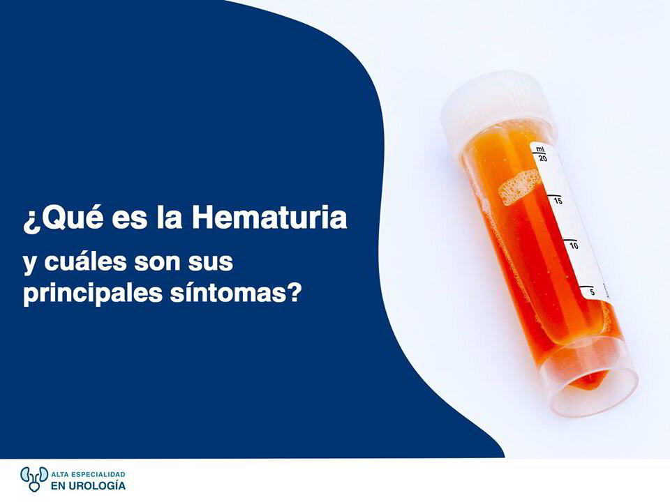 ¿Qué es la Hematuria y cuáles son principales causas?