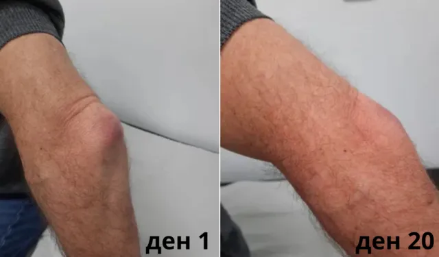 Болките в ставите