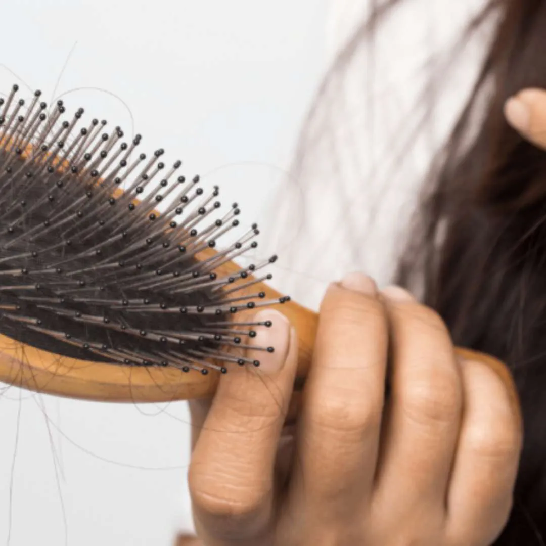 5 Reasons Why You Might Be Losing Your Hair