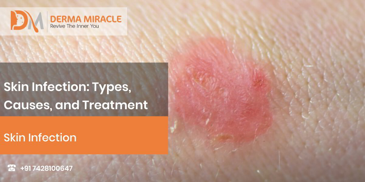 Skin Infection Types, Causes, and Treatment