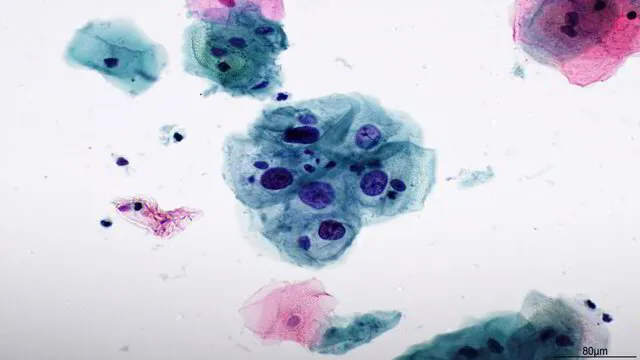 View of Histopathology Page